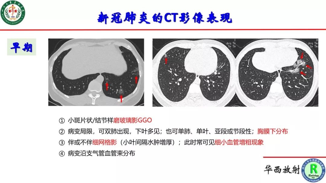 新冠状病毒什么时候能结束/新冠状病毒什么时候能结束啊