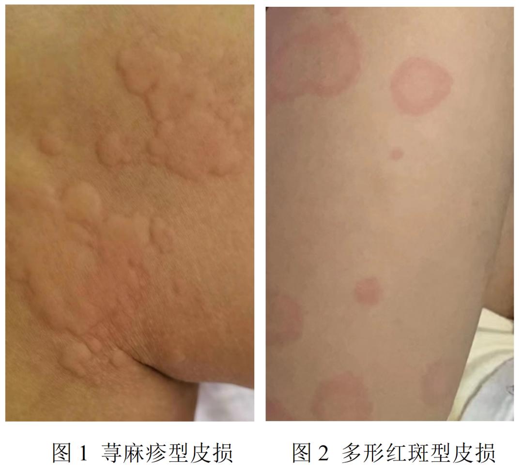 【新冠病毒到底什么时候结束,新冠病毒到底什么时候结束的】