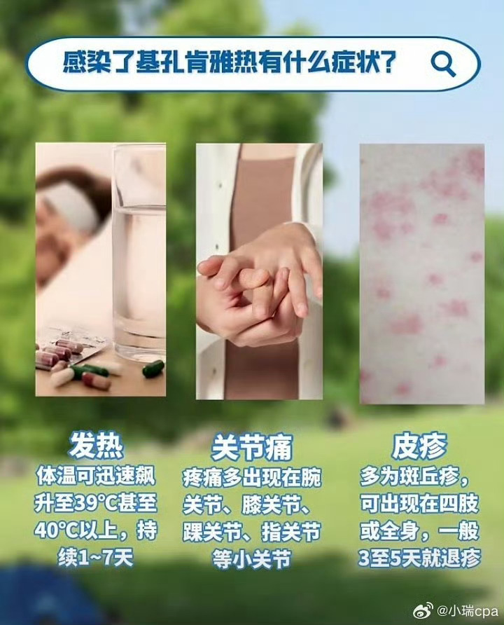 【基孔肯尼亚热有什么症状怎么治疗/肯尼亚基普亚根】