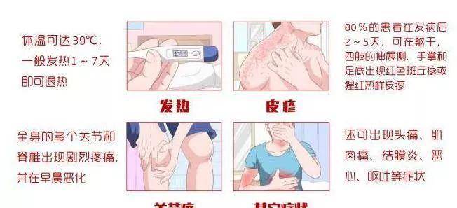 基孔肯雅热需要隔离吗:基孔肯尼亚病毒的临床表现