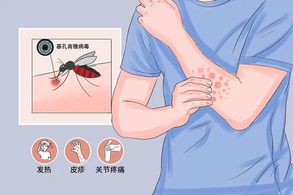 登革热出红疹图片（登革热红疹图片和过敏皮炎图片）