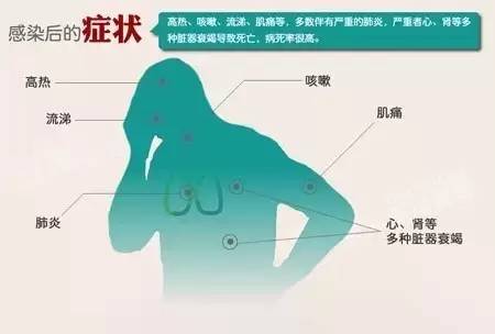 浙江最近爆发的传染病/浙江最近爆发的传染病2024年2月
