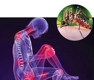 基孔肯雅热今天最新消息/基孔肯尼亚病毒怎么治疗