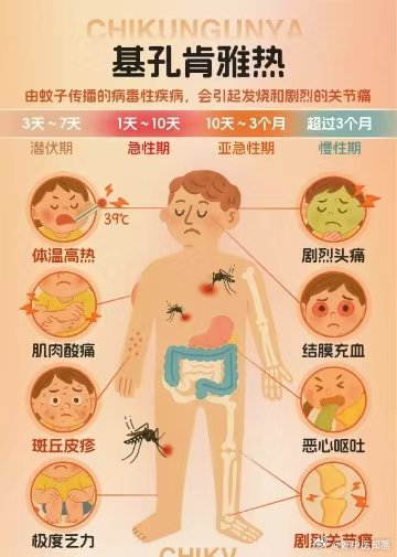基孔肯尼亚热最突出的症状是（基孔肯尼亚病毒的临床表现）
