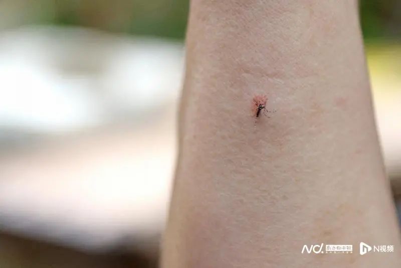 伊蚊和普通蚊子咬的包:被伊蚊咬了伤口表面图