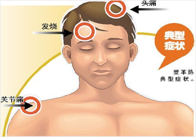 基孔肯尼亚热皮疹特点/基孔肯尼亚病毒的临床表现